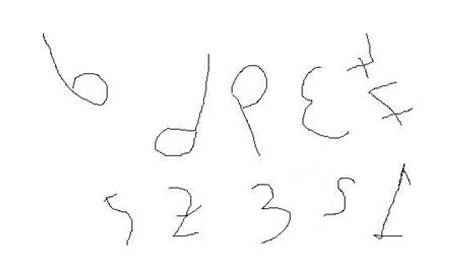 Ankara Disleksi,Ankara Dikkat Eksikliği,Ankara Ergoterapi